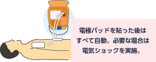 電極パッドを貼った後、必要な場合は自動で電気ショックを実施
