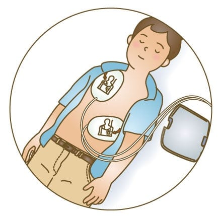 guideline2020 cpr flow07 1 【知っておきたい】AED電極パッドを貼る位置とケース別注意点