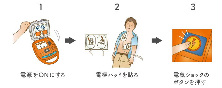 AEDの使用